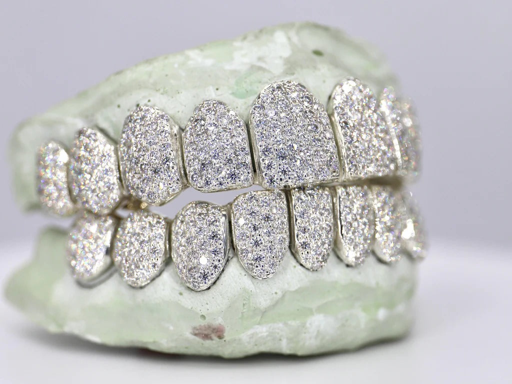 10 on 10 VVS White Moisannite Diamond Grillz