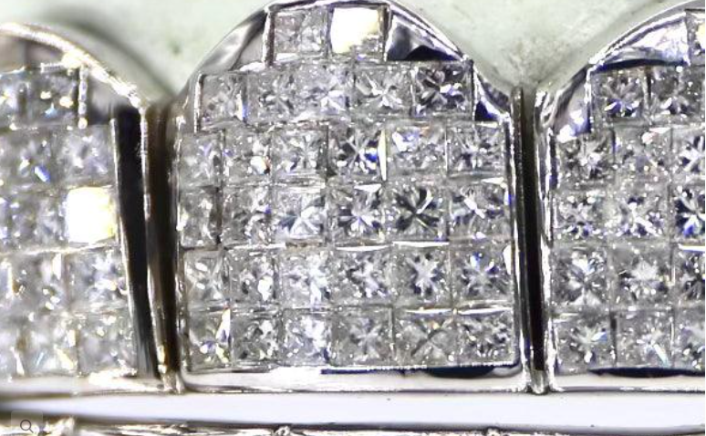 VVS Moissanite , Starling Silver ,White Gold plated,8 Top and Bottom Grillz by diamond grillz VVS Grillz
