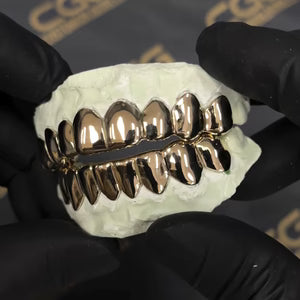 "Solid Gold Deep Cut Moissanite Grillz for Women – Iced Out Custom Diamond-Look Teeth Jewelry"