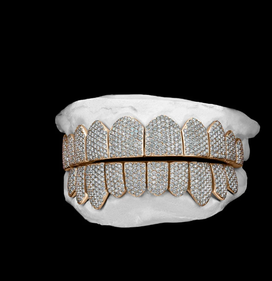 MW Lavish Shinny VVS Moissanite 925 Sterling Silver White Gold Plated Grillz Hip Hop MW_G1010