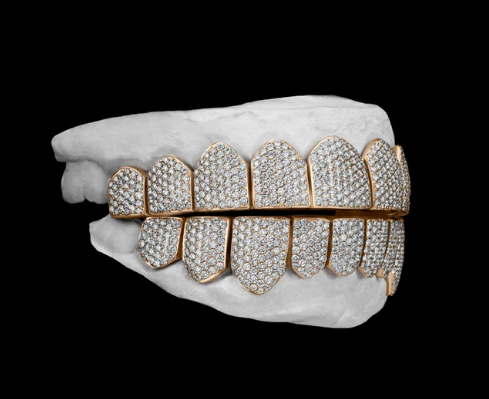 MW Luxury VVS Moissanite 925 Sterling Silver White Gold Plated Grillz Hip Hop MW_G1009