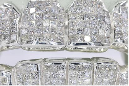VVS Moissanite , Starling Silver ,White Gold plated,8 Top and Bottom Grillz by diamond grillz VVS Grillz