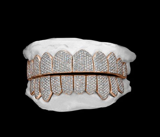 MW Luxury VVS Moissanite 925 Sterling Silver White Gold Plated Grillz Hip Hop MW_G1009