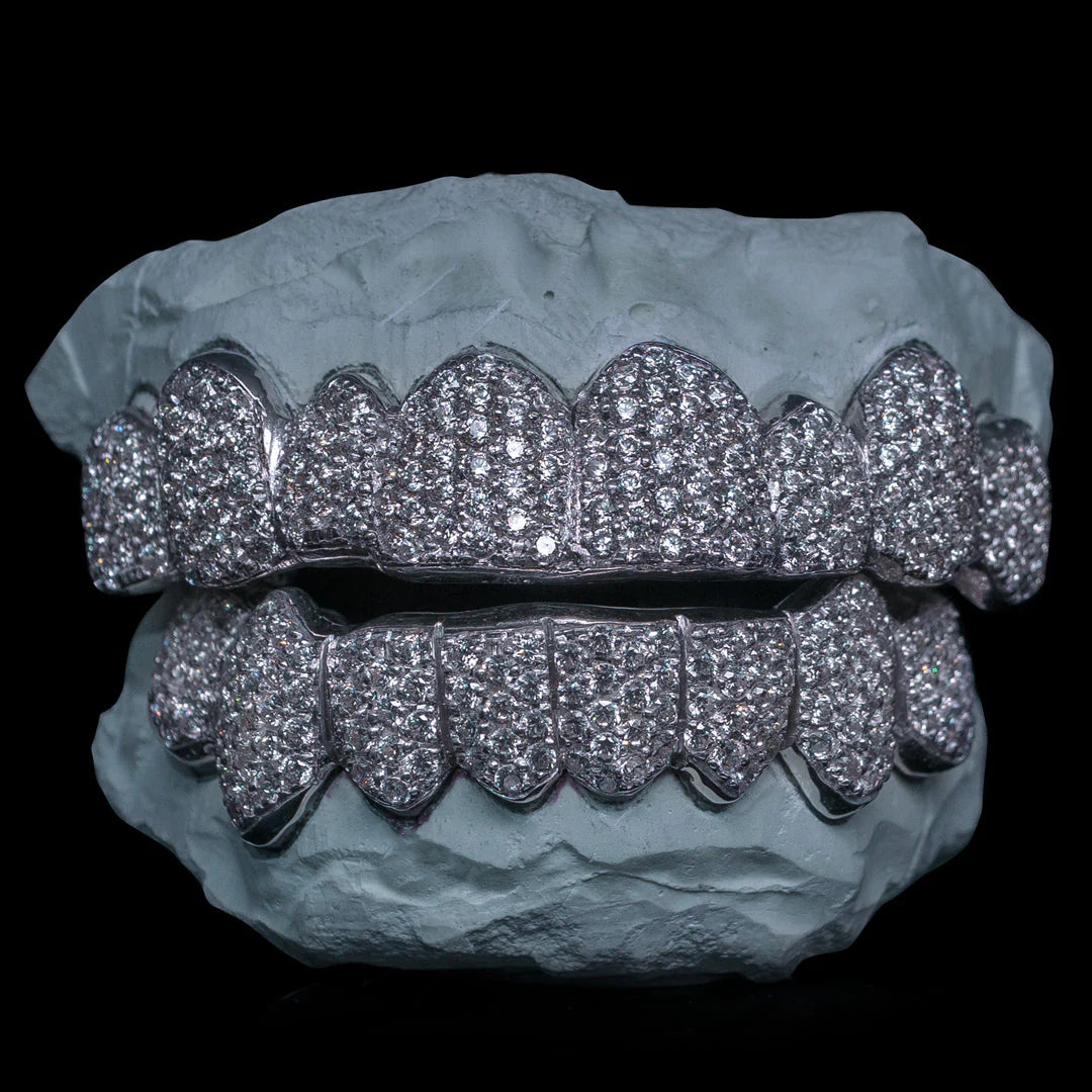 "Iced VVS Moissanite Grillz for Women – Zig Zag Setting Diamond-Look Teeth Jewelry in Custom Fit Design"
