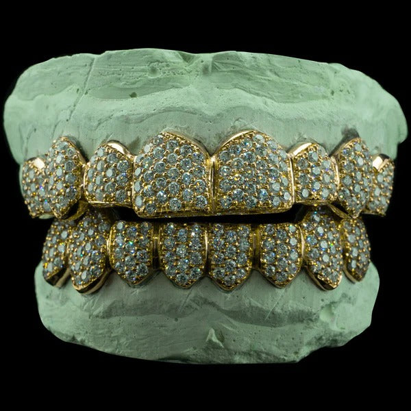 Iced VVS Moissanite Grillz (Zig Zag Setting)