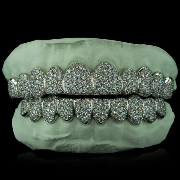 Iced VVS Moissanite Grillz (Zig Zag Setting)