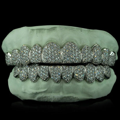 Iced VVS Moissanite Grillz (Zig Zag Setting)