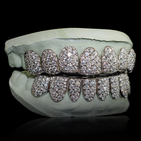 Iced VVS Moissanite Grillz with Large Moissanites (Zig Zag Setting)