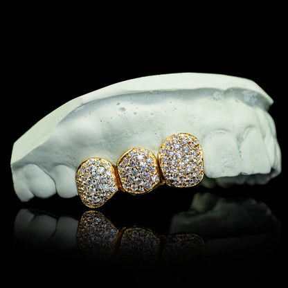 Iced Triple Cap VVS Moissanite Grillz