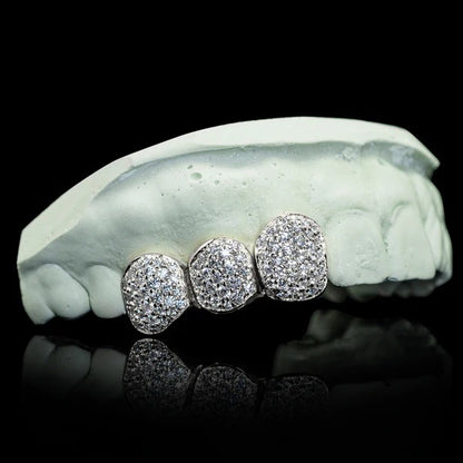 Iced Triple Cap VVS Moissanite Grillz