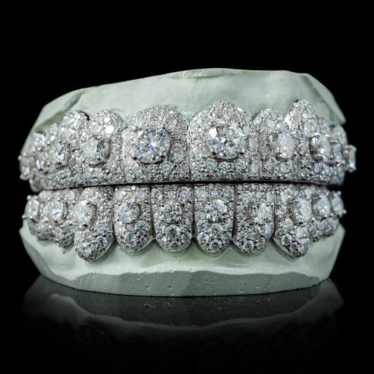 Iced VVS Moissanite Grillz with Large Center Stone