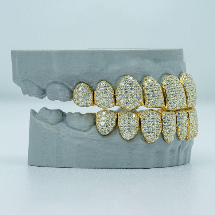 S925 Moissanite Custom Full Bust Down Grillz