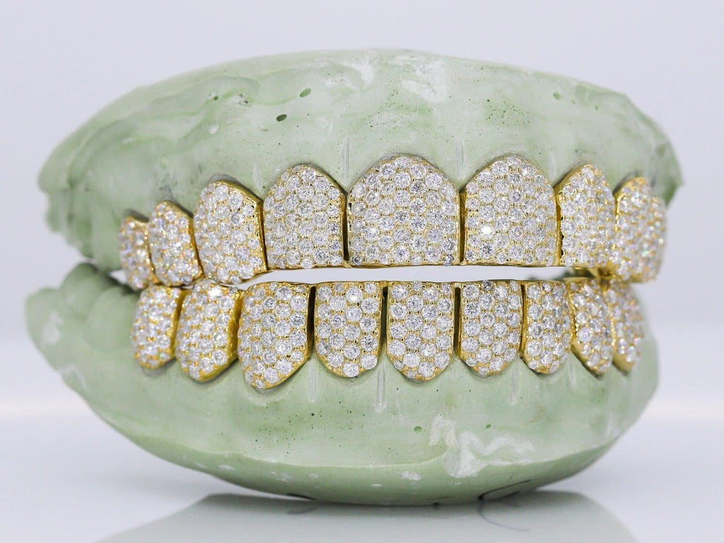 10 on 10 VVS Gold Moisannite Diamond Grillz