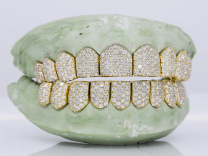 10 on 10 VVS Gold Moisannite Diamond Grillz