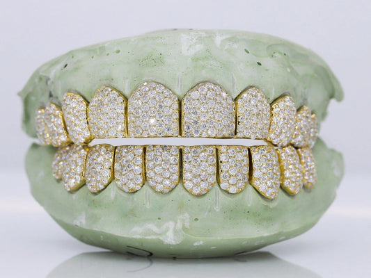 10 on 10 VVS Gold Moisannite Diamond Grillz