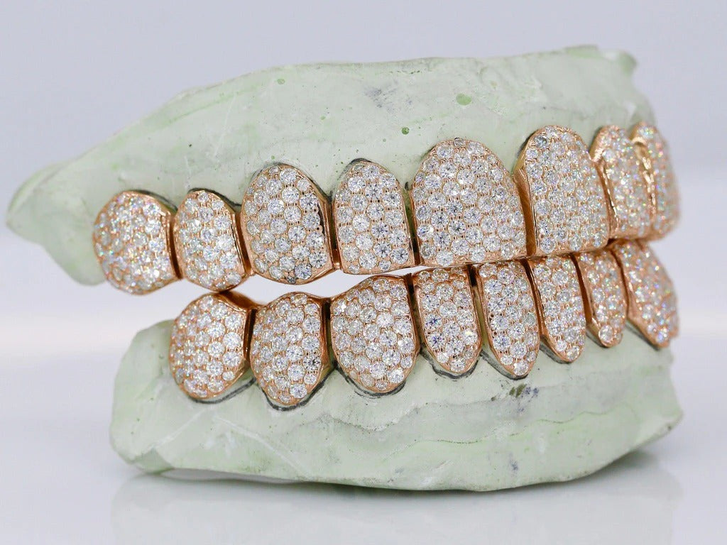 10 on 10 VVS Rose Gold Moisannite Diamond Grillz