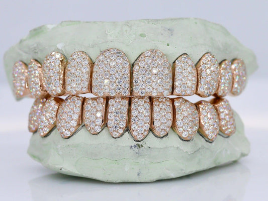 10 on 10 VVS Rose Gold Moisannite Diamond Grillz
