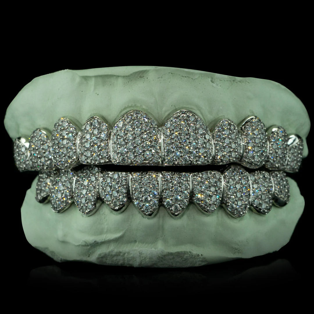 "Iced VVS Moissanite Grillz for Women – Zig Zag Setting Diamond-Look Teeth Jewelry in Custom Fit Design"