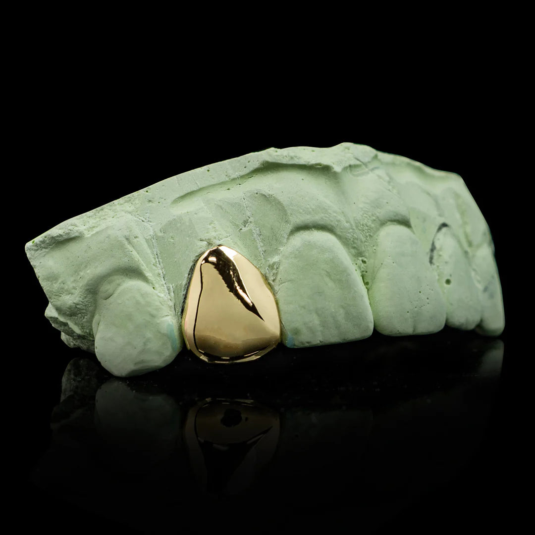 "Solid Gold Single Tooth Moissanite Grillz for Women – Custom Iced Out Diamond-Look Teeth Jewelry"