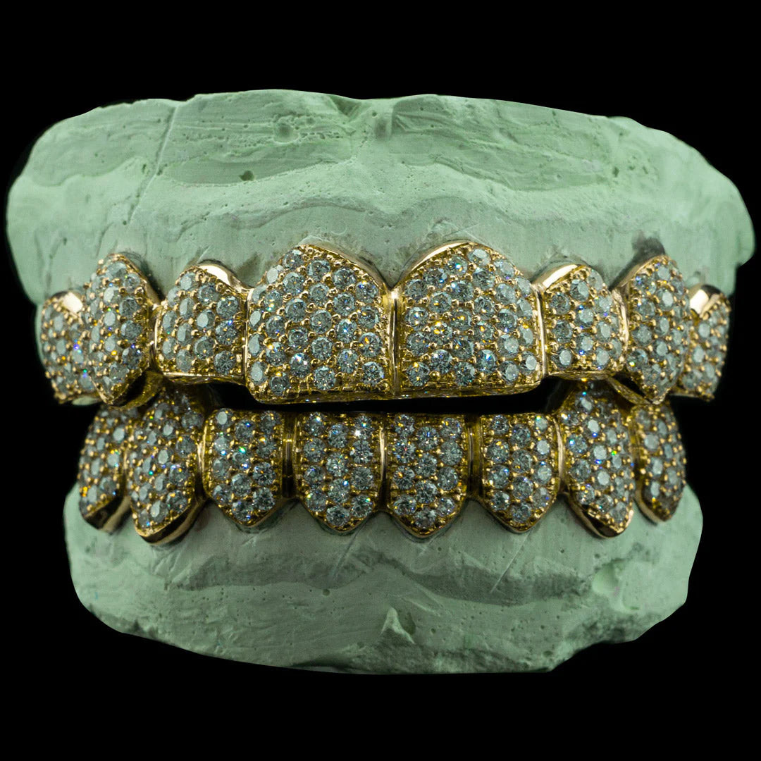 "Iced VVS Moissanite Grillz for Women – Zig Zag Setting Diamond-Look Teeth Jewelry in Custom Fit Design"
