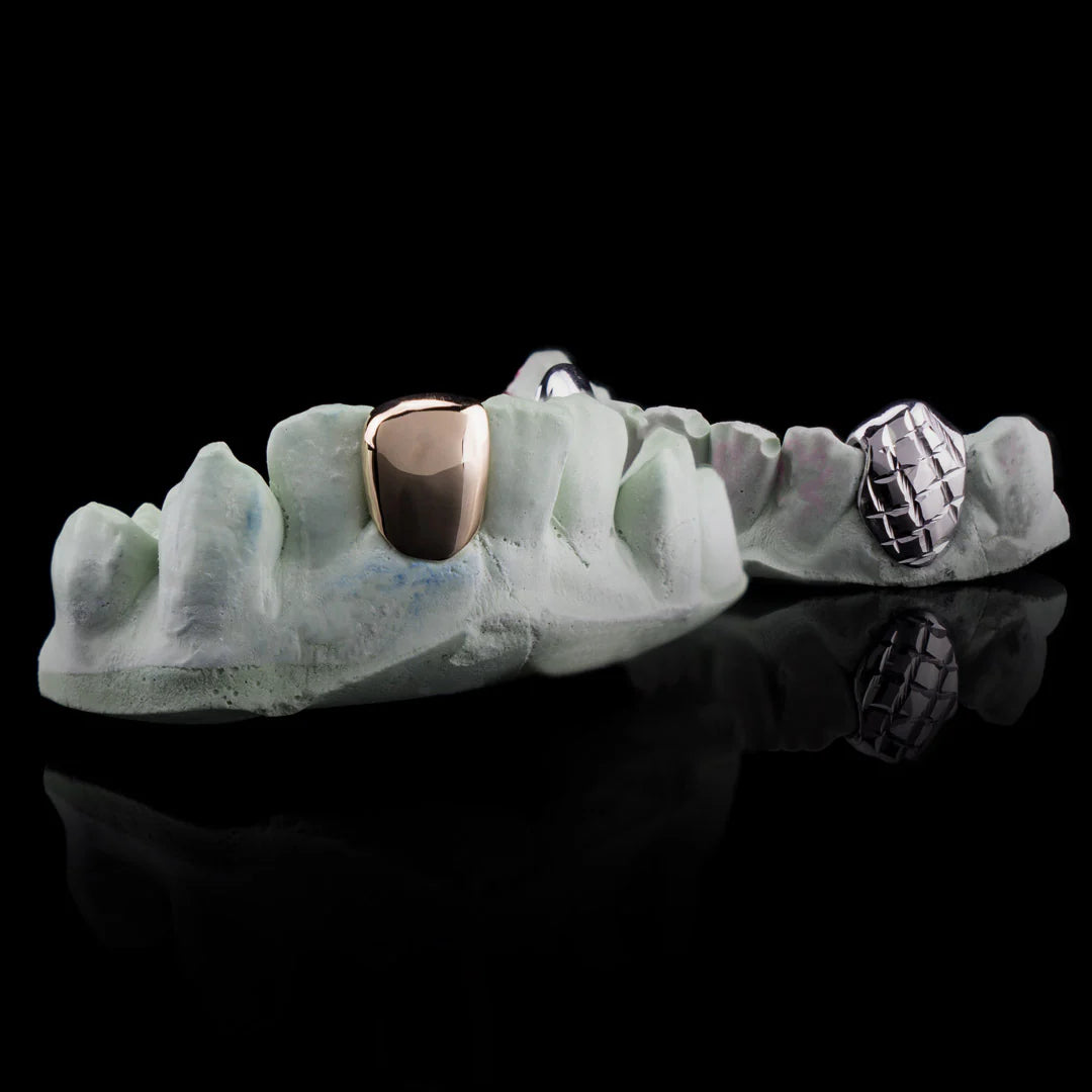 "Solid Gold Single Tooth Moissanite Grillz for Women – Custom Iced Out Diamond-Look Teeth Jewelry"